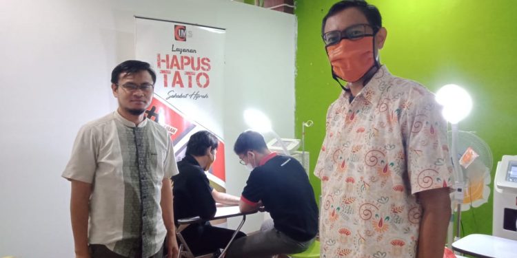 Program Hapus Tatto